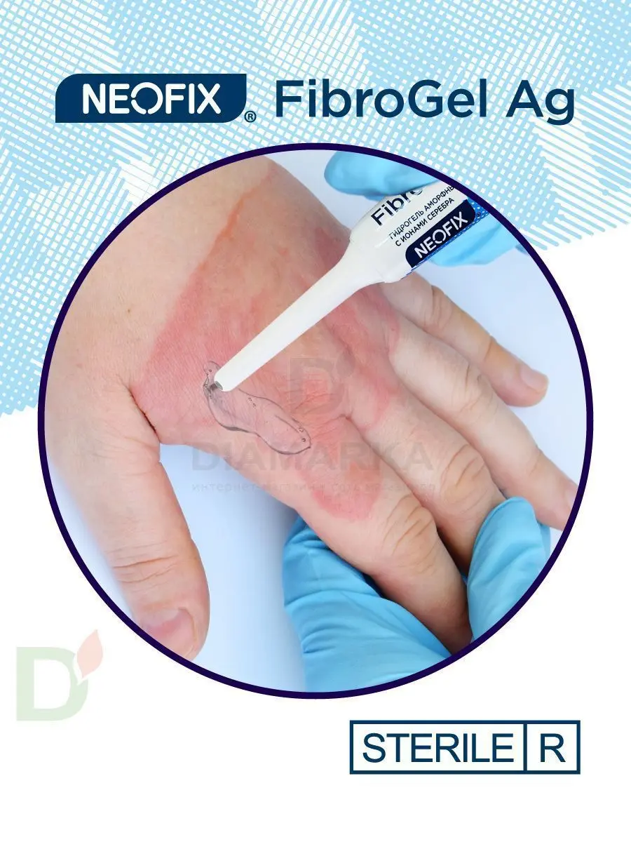 Гидрогель антимикробный NEOFIX FibroGel Fg с ионами серебра 15г в Краснодаре